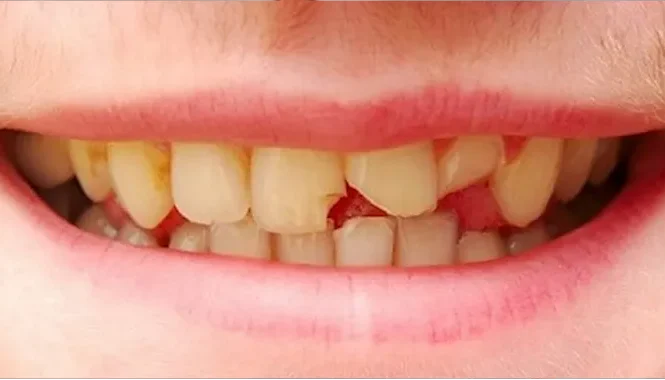 پست و کور کلینیک صدرا