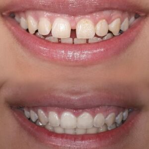 نمونه کار ارتودنسی کلینیک دندانپزشکی صدرا
