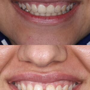 نمونه کار ارتودنسی کلینیک دندانپزشکی صدرا