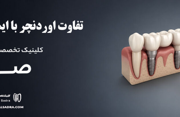 تفاوت اوردنچر با ایمپلنت دندان