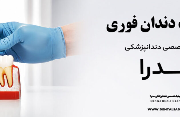 ایمپلنت دندان فوری