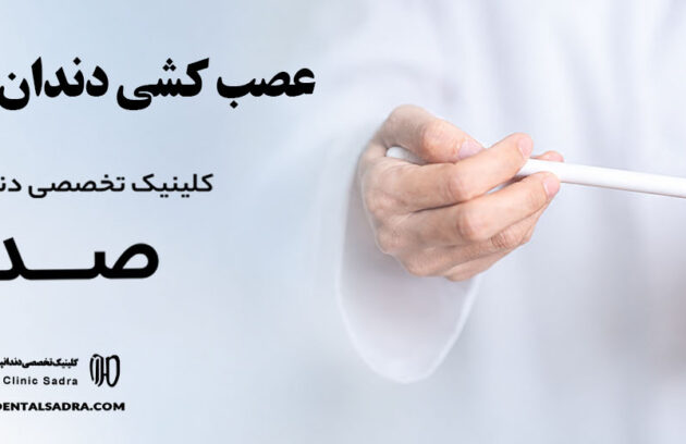 عصب کشی دندان در یاسوج | متخصص عصب کشی در یاسوج