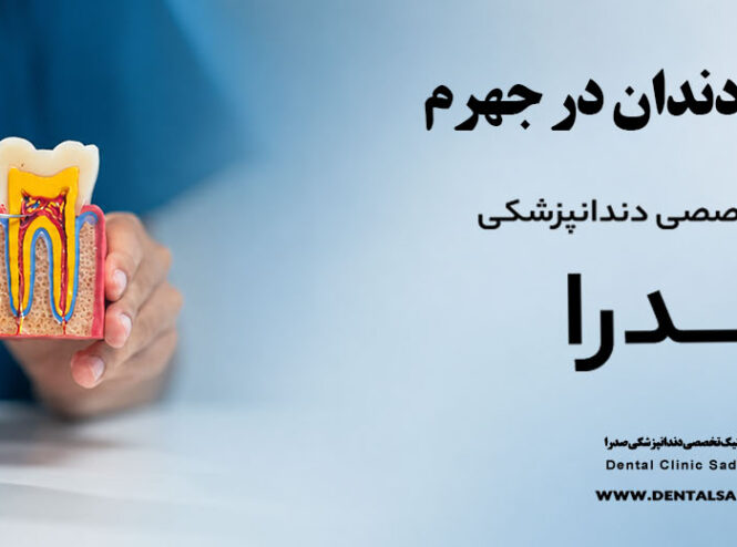 عصب کشی دندان در جهرم | متخصص عصب کشی در جهرم