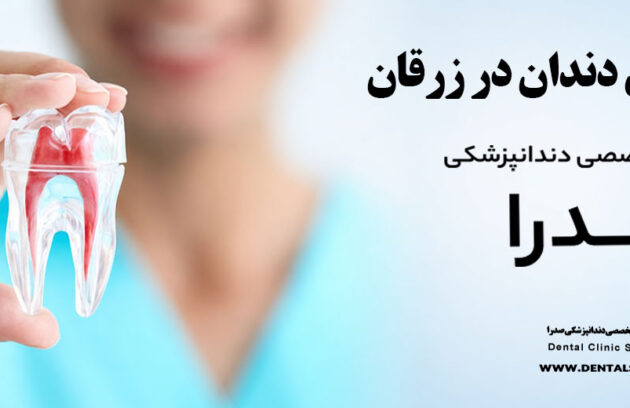 عصب کشی دندان در زرقان | متخصص عصب کشی در زرقان