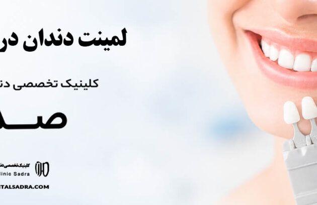 لمینت دندان در یاسوج | متخصص لمینت در یاسوج