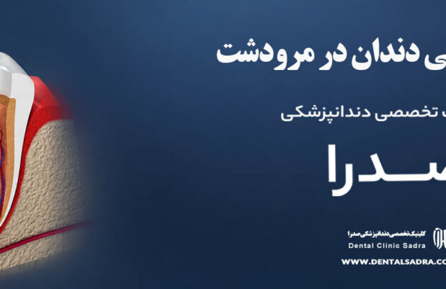 عصب کشی دندان در مرودشت | متخصص عصب کشی در مرودشت